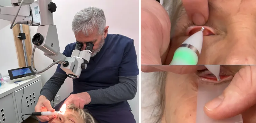 Professor Pablo Dighiero at the slit lamp treating the upper and lower eyelids with the JETT silver-tip applicator, with two close-up views of the applicator on the eyelid