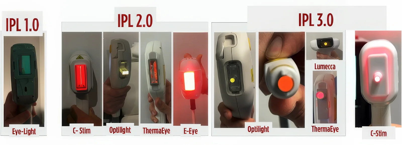 Three generations of IPL devices used in ophthalmology, from dermatology-based systems to ophthalmic systems with miniaturized light guides