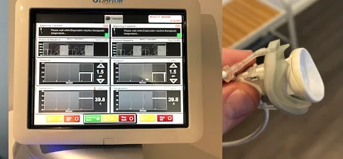LipiFlow treatment console screen and single-use activator