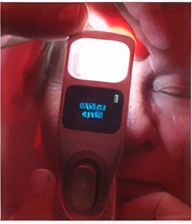 iLux handheld device with illuminated eyelid view