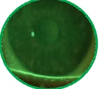 Fluorescein view of a cornea without staining