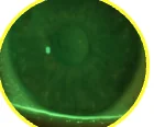 Cornea without staining