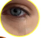 Eye with reflex tearing