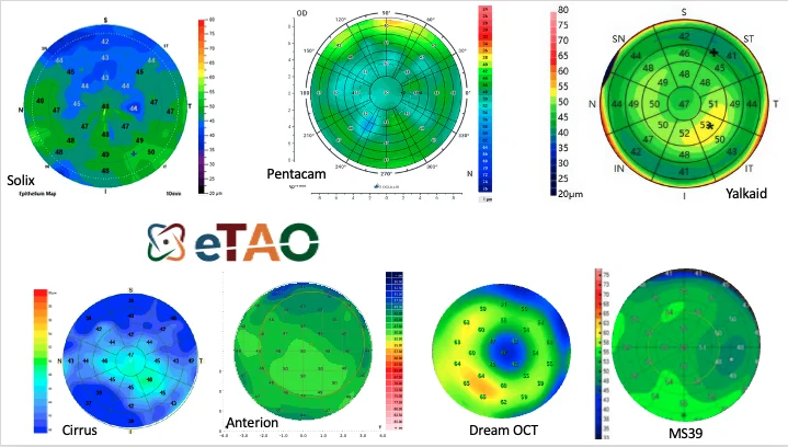 Corneal epithelial thickness maps from seven anterior-segment OCT platforms: Solix, Pentacam, Yalkaid, Cirrus, Anterion, Dream OCT and MS39
